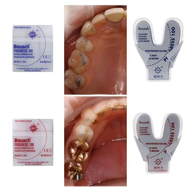 Bausch BK51 BK52 BK53 BK54 Den - Bite Indicator 评论和价格